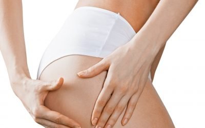 Cellulite : quali sono le cause e gli errori più comuni?